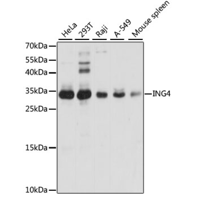 ING4 Rabbit Polyclonal Antibody
