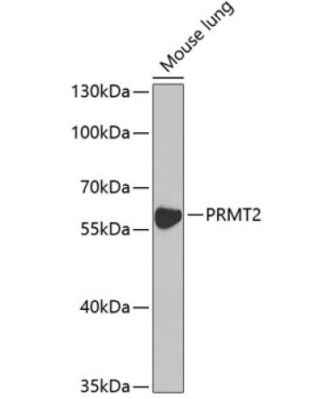 PRMT2 Rabbit Polyclonal Antibody [KO Validated]
