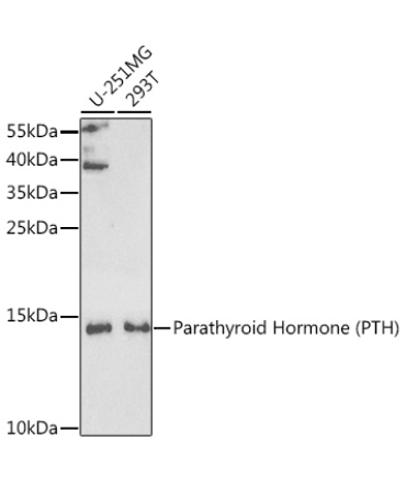 Parathyroid Hormone (PTH) Rabbit Polyclonal Antibody