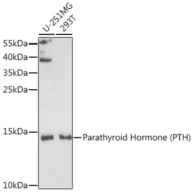 Parathyroid Hormone (PTH) Rabbit Polyclonal Antibody