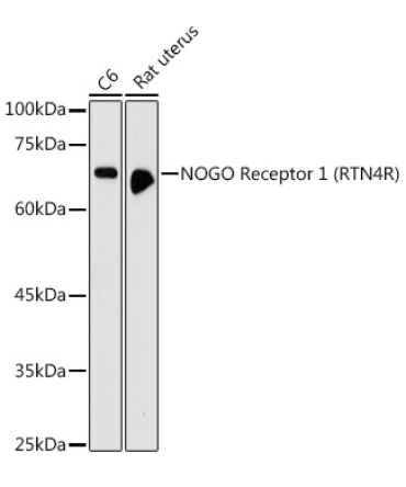 NOGO Receptor 1 (RTN4R) Rabbit Polyclonal Antibody