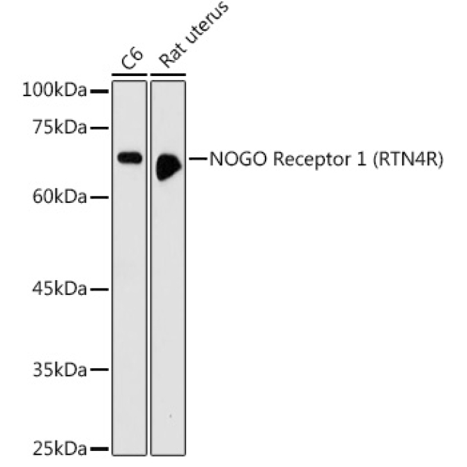 NOGO Receptor 1 (RTN4R) Rabbit Polyclonal Antibody