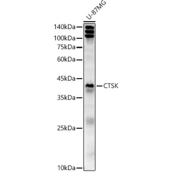 CTSK Rabbit Polyclonal Antibody