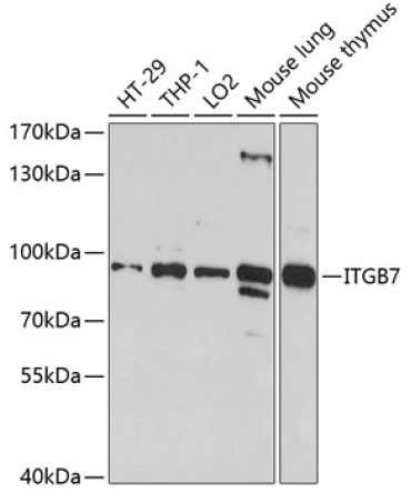 ITGB7 Rabbit Polyclonal Antibody