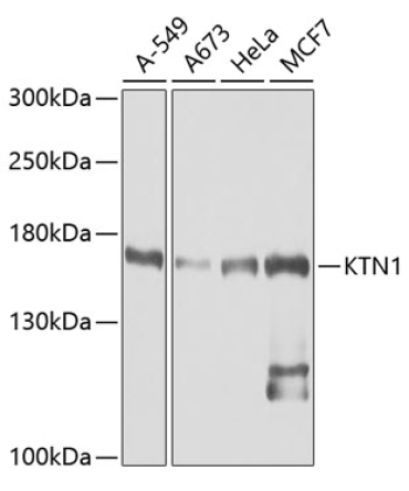 KTN1 Rabbit Polyclonal Antibody