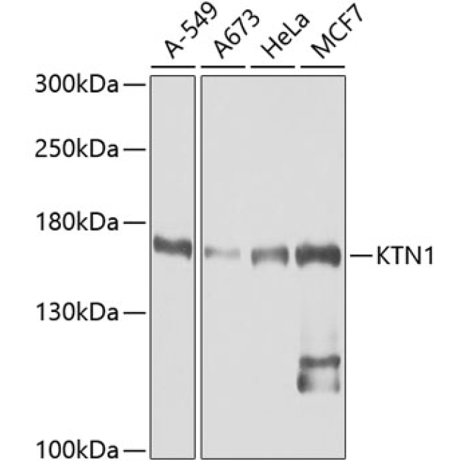 KTN1 Rabbit Polyclonal Antibody