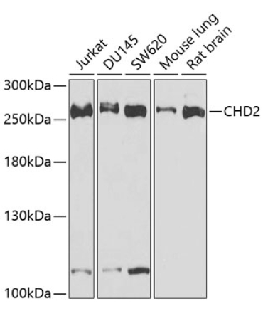 CHD2 Rabbit Polyclonal Antibody