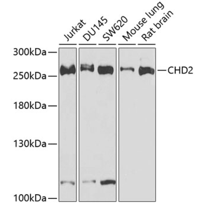 CHD2 Rabbit Polyclonal Antibody