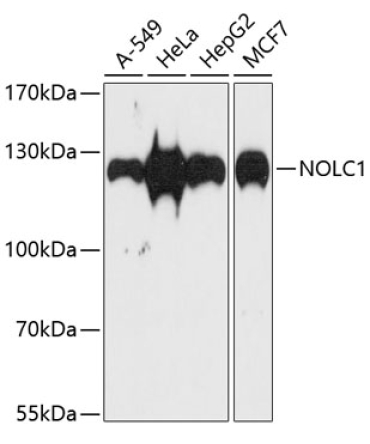 NOLC1 Rabbit Polyclonal Antibody
