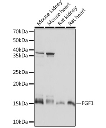 FGF1 Rabbit Monoclonal Antibody