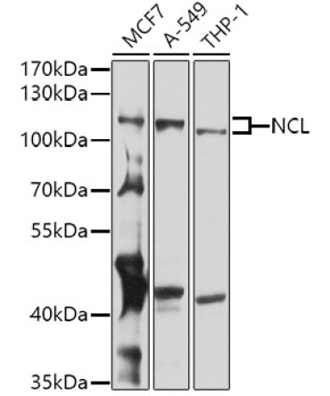 NCL Rabbit Polyclonal Antibody