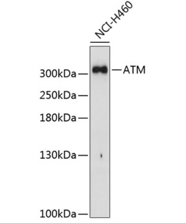 ATM Rabbit Polyclonal Antibody