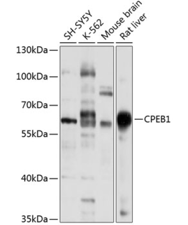 CPEB1 Rabbit Polyclonal Antibody