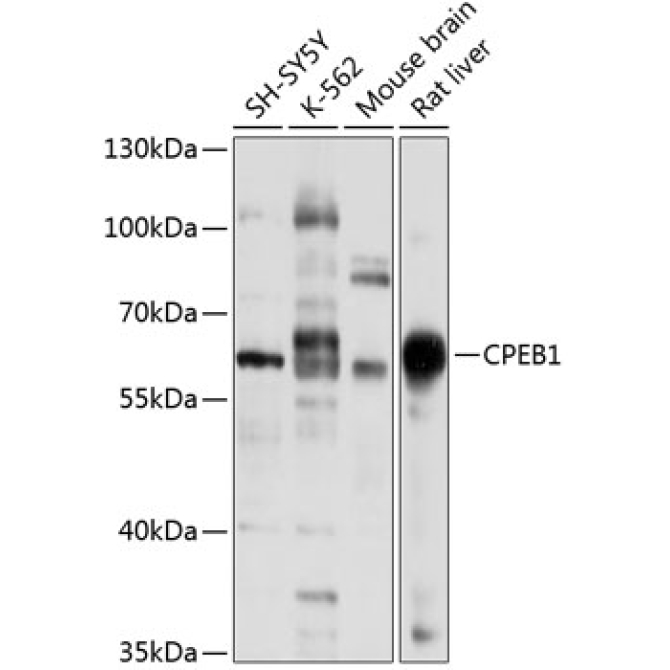 CPEB1 Rabbit Polyclonal Antibody