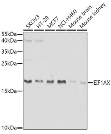 EIF1AX Rabbit Polyclonal Antibody