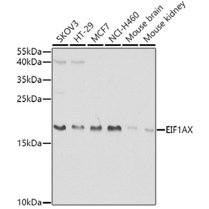 EIF1AX Rabbit Polyclonal Antibody