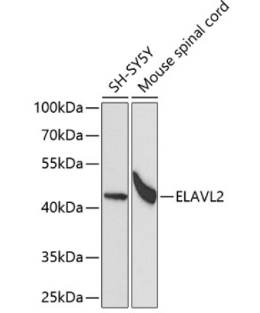 ELAVL2 Rabbit Polyclonal Antibody