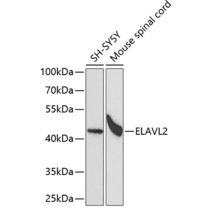 ELAVL2 Rabbit Polyclonal Antibody