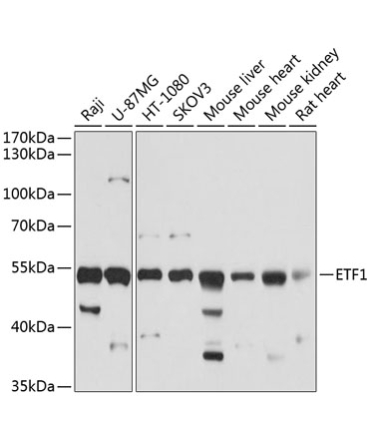 ETF1 Rabbit Polyclonal Antibody