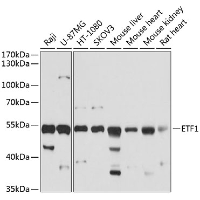 ETF1 Rabbit Polyclonal Antibody