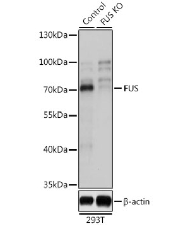 FUS Rabbit Polyclonal Antibody [KO Validated]