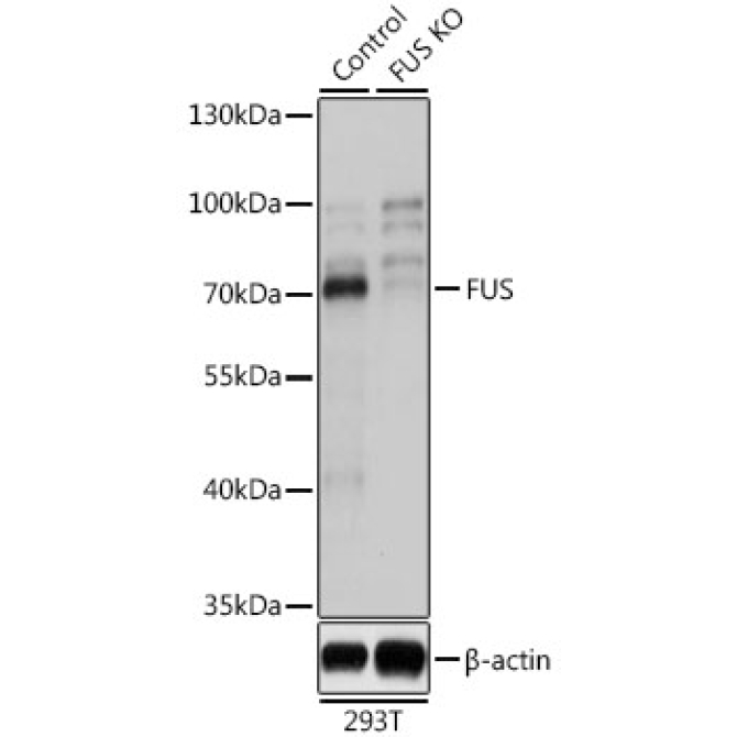 FUS Rabbit Polyclonal Antibody [KO Validated]