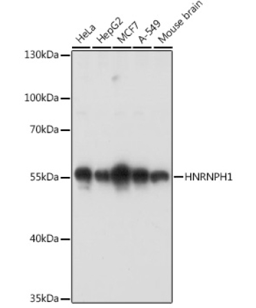 HNRNPH1 Rabbit Polyclonal Antibody