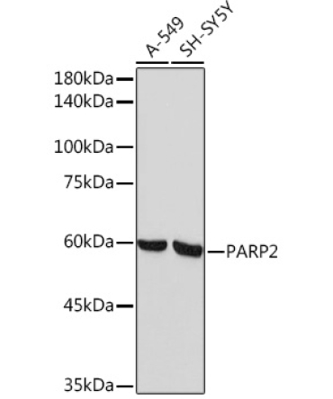 PARP2 Rabbit Monoclonal Antibody