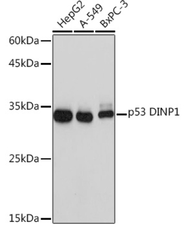p53 DINP1 Rabbit Monoclonal Antibody