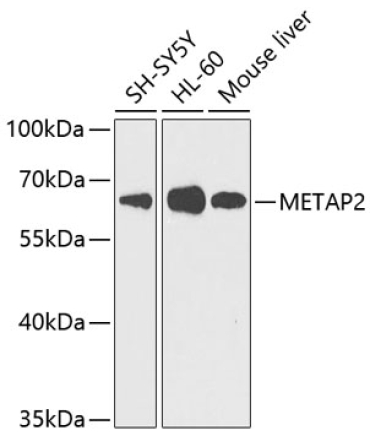 METAP2 Rabbit Polyclonal Antibody