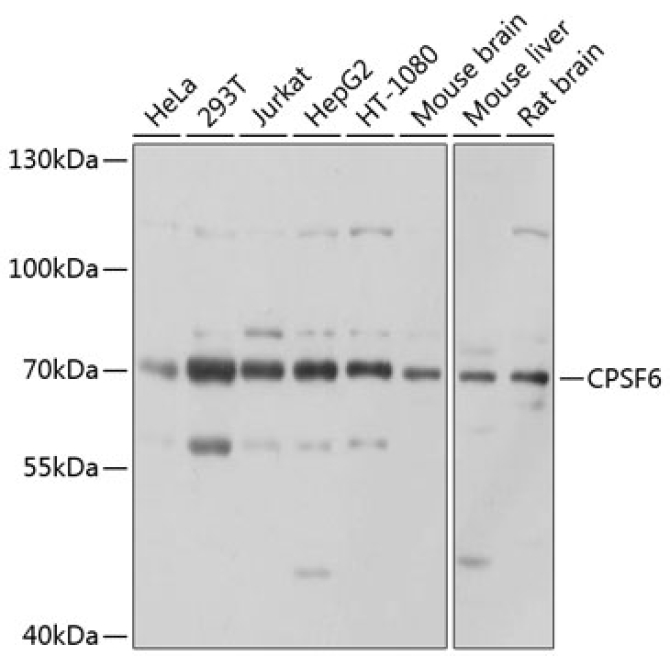 CPSF6 Rabbit Polyclonal Antibody