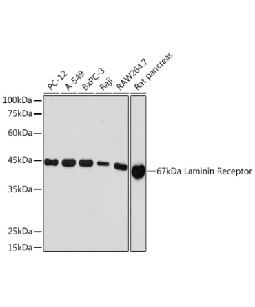 67kDa Laminin Receptor Rabbit Monoclonal Antibody