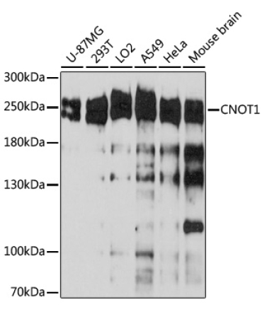 CNOT1 Rabbit Polyclonal Antibody