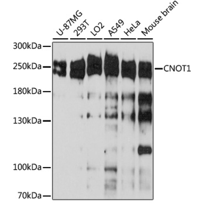CNOT1 Rabbit Polyclonal Antibody