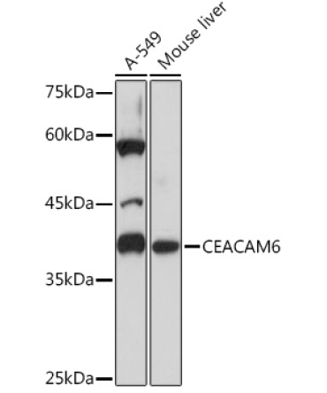 CEACAM6 Rabbit Monoclonal Antibody
