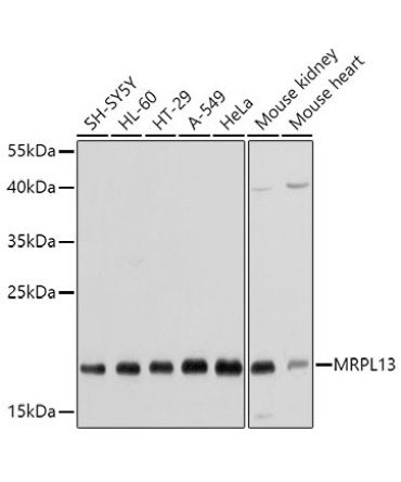 MRPL13 Rabbit Polyclonal Antibody
