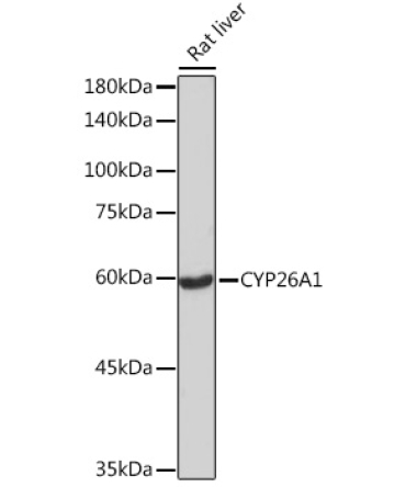 CYP26A1 Rabbit Monoclonal Antibody