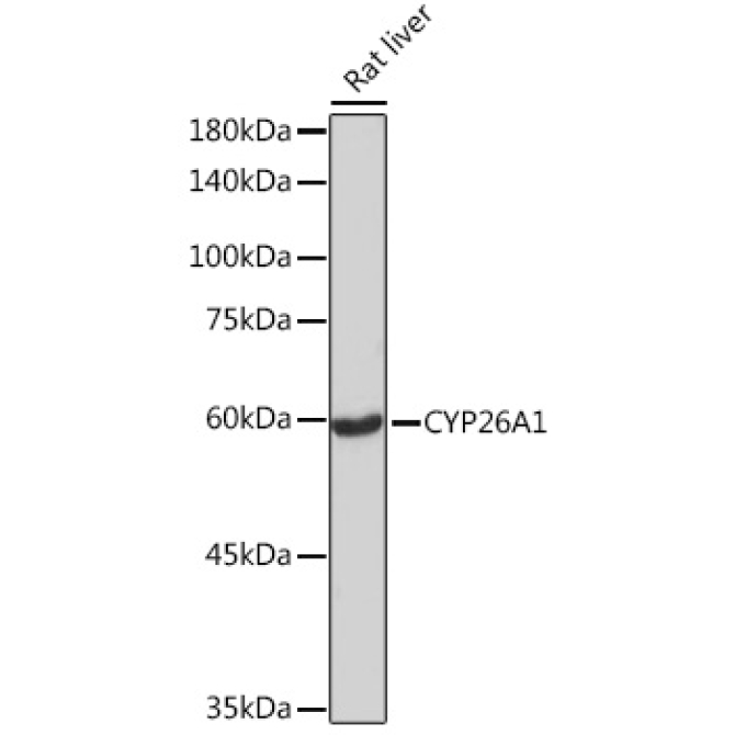 CYP26A1 Rabbit Monoclonal Antibody