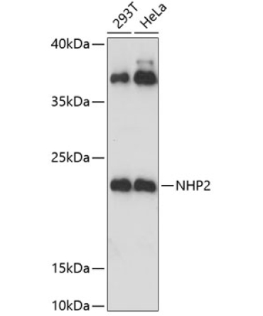 NHP2 Rabbit Polyclonal Antibody