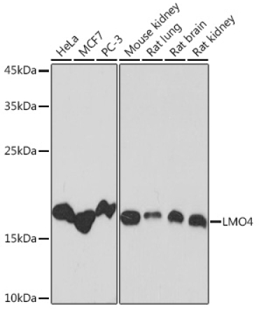 LMO4 Rabbit Monoclonal Antibody