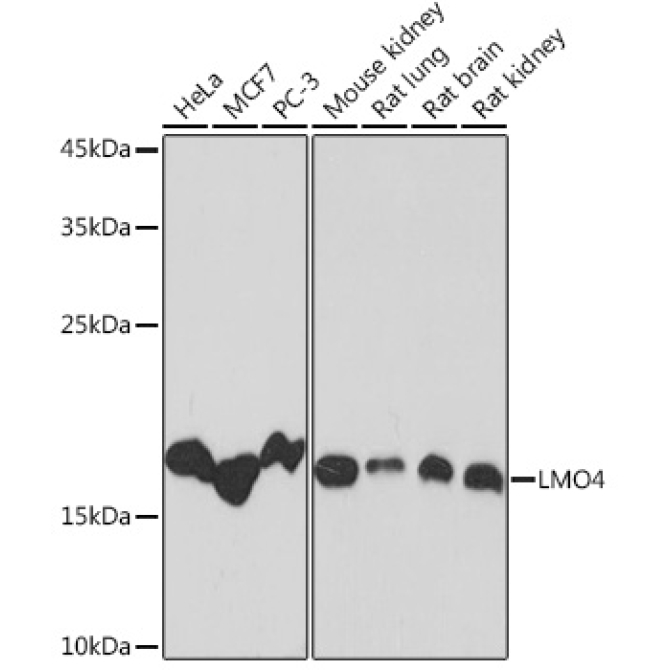LMO4 Rabbit Monoclonal Antibody