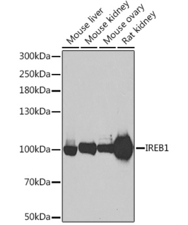 Aconitase 1 (ACO1) Rabbit Polyclonal Antibody