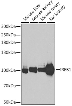 Aconitase 1 (ACO1) Rabbit Polyclonal Antibody