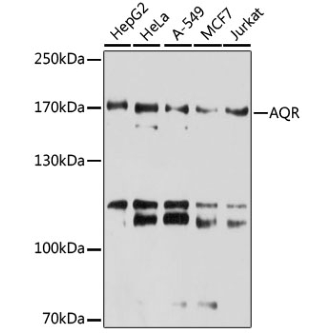 AQR Rabbit Polyclonal Antibody