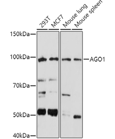 AGO1 Rabbit Polyclonal Antibody