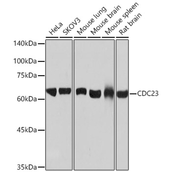 CDC23 Rabbit Monoclonal Antibody