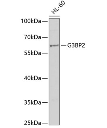 G3BP2 Rabbit Polyclonal Antibody