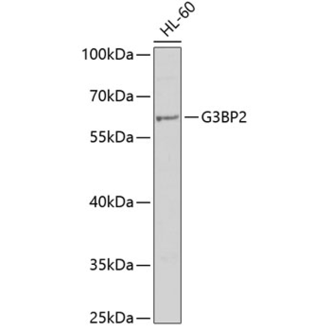 G3BP2 Rabbit Polyclonal Antibody
