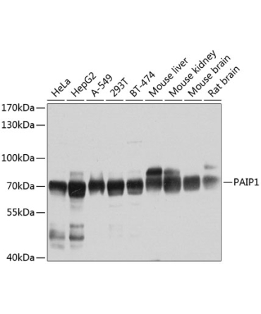 PAIP1 Rabbit Polyclonal Antibody