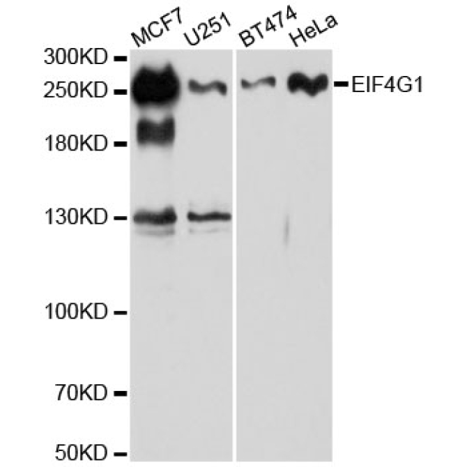 EIF4G1 Rabbit Polyclonal Antibody